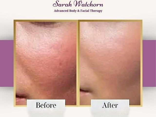 before-after-2-kireth-ai-kireth-ai