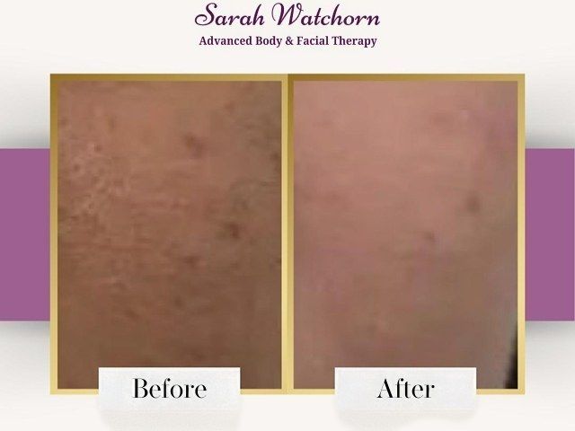 before-after-3-kireth-ai