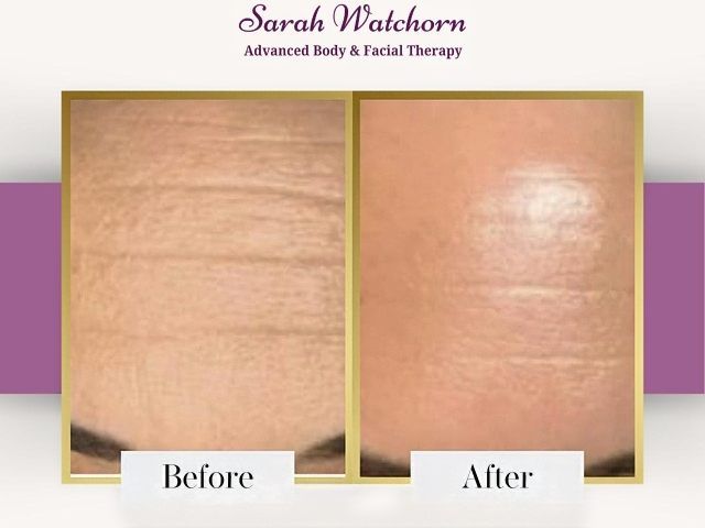 before-after-4-kireth-ai