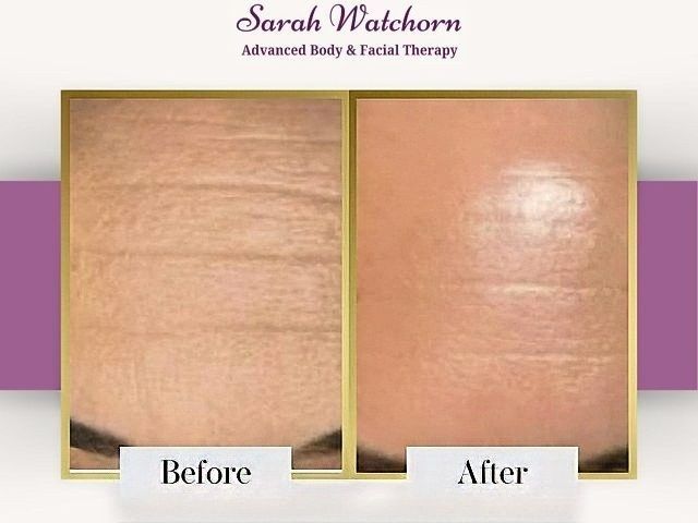 before-after-4-kireth-ai-kireth-ai