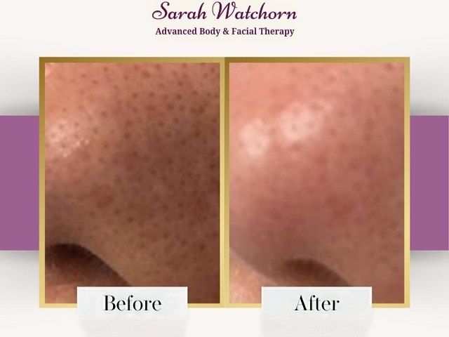before-after-1-kireth-ai