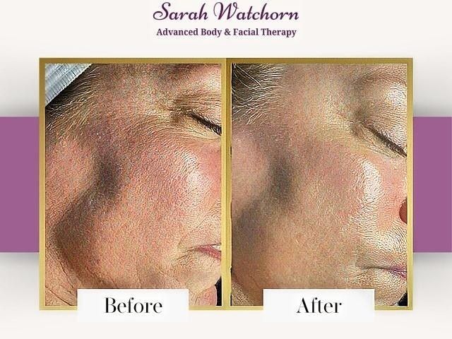 before-after-5-kireth-ai-kireth-ai