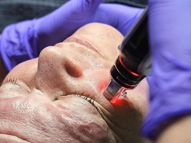 derma-pro-fusion-facials-4-kireth-ai