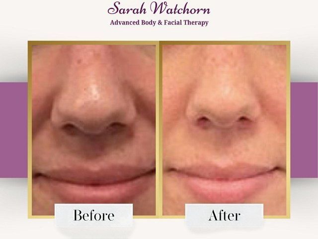 before-after-8-kireth-ai