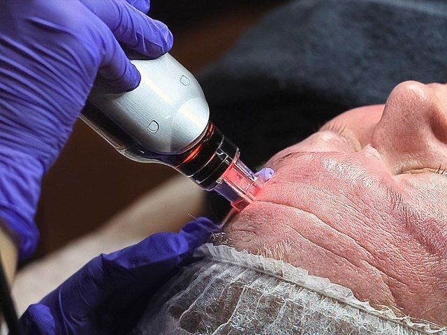 derma-pro-fusion-facials-8-kireth-ai