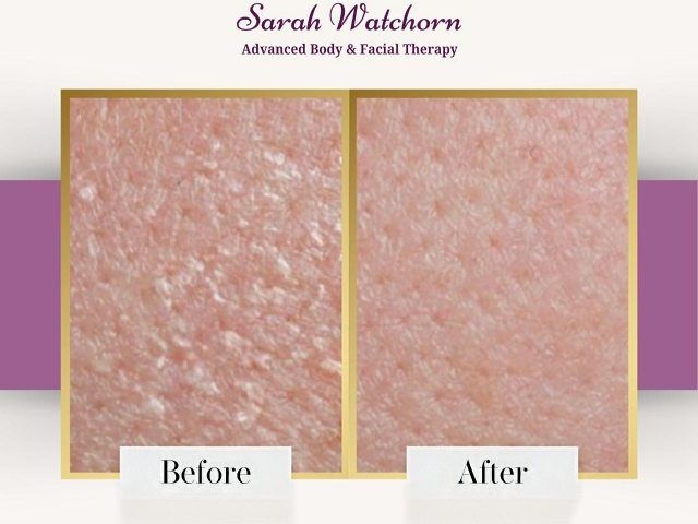 before-after-7-kireth-ai