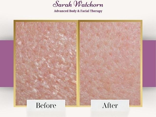 before-after-7-kireth-ai