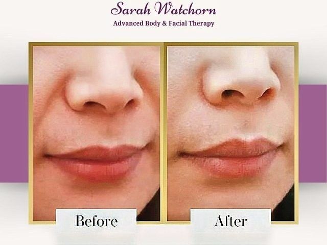 before-after-10-kireth-ai-kireth-ai