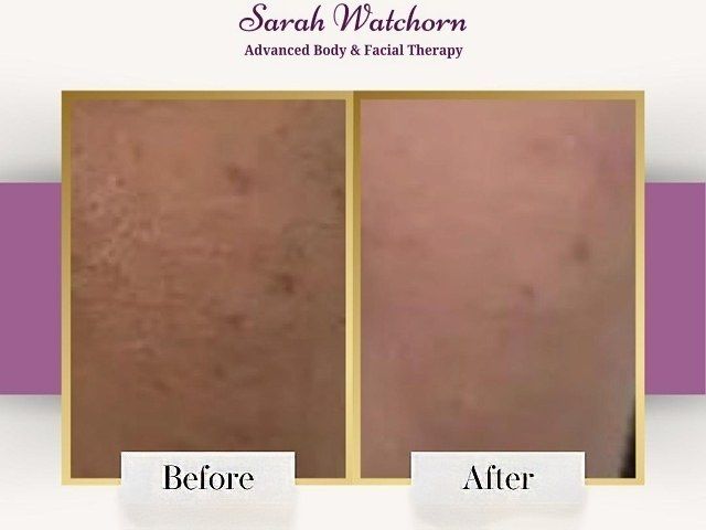 before-after-3-kireth-ai-kireth-ai
