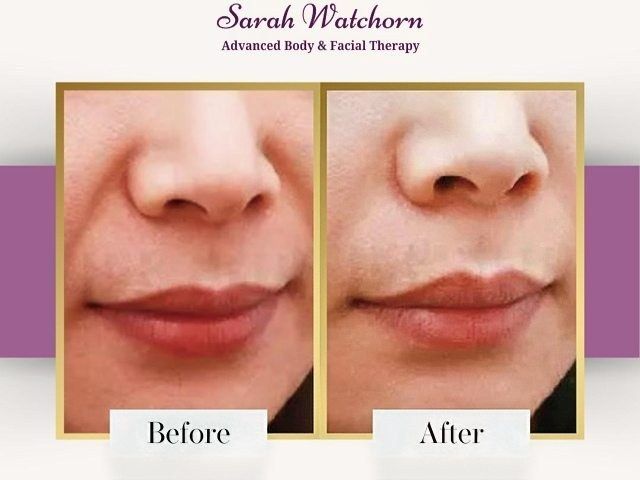 before-after-10-kireth-ai