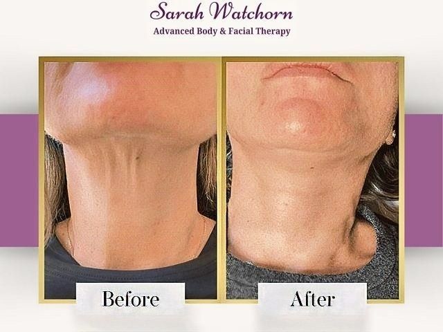 before-after-6-kireth-ai-kireth-ai