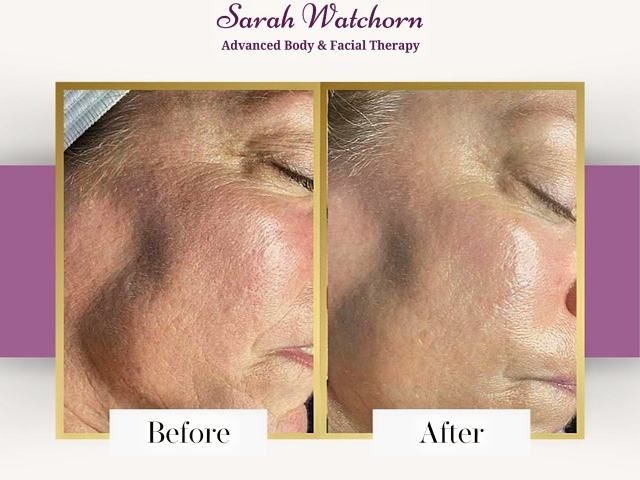 before-after-5-kireth-ai