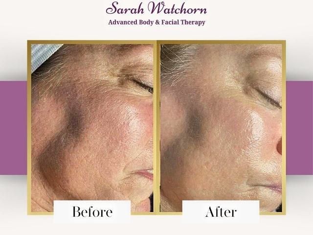 before-after-5-kireth-ai